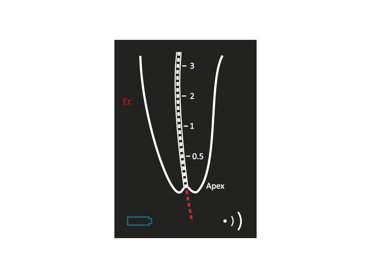 IONYX LOCAPEX 6 APEX LOCATOR APICAL EXCESS